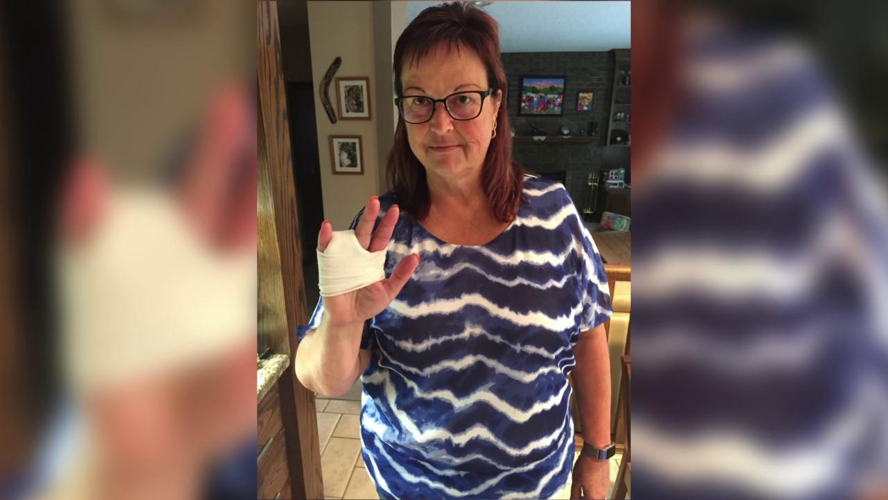 Woman Loses Finger In Water Park Accident