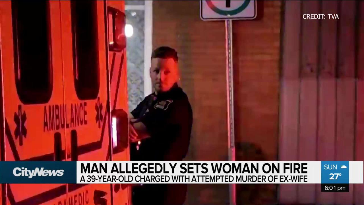 Man charged after allegedly setting his ex-wife on fire
